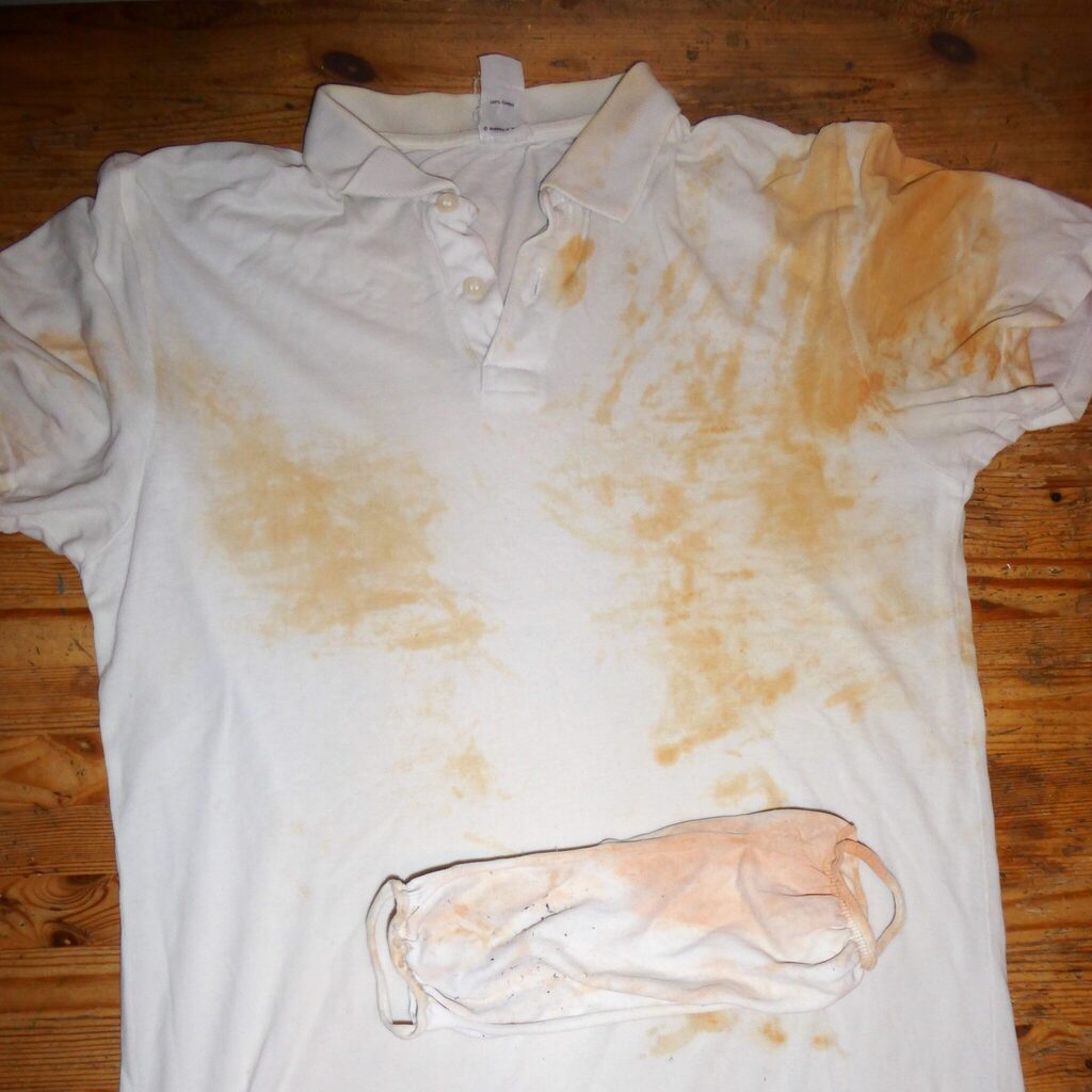 Remove Stain From White Clothes With 7 Easy DIY Hacks!